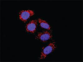 Anti-RPS6KA3 + PDPK1 Polyclonal Antibody Pair