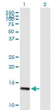 Anti-DEFA6 Mouse Polyclonal Antibody