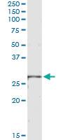 Anti-LRRK1 Antibody Pair