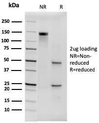 SDS-PAGE analysis of Anti-His Tag Antibody [6HIS/3550] under non-reduced and reduced conditions; showing intact IgG and intact heavy and light chains, respectively. SDS-PAGE analysis confirms the integrity and purity of the antibody.