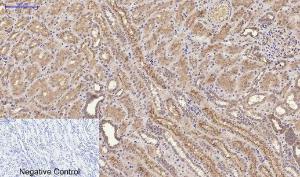 Immunohistochemical analysis of paraffin-embedded human kidney tissue using Anti-FAS Antibody at 1:200 (4°C overnight). Negative control was secondary antibody only.