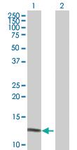 Anti-DEFA6 Rabbit Polyclonal Antibody