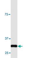 Anti-ACTA1 Polyclonal Antibody