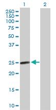 Anti-AGPAT2 Mouse Polyclonal Antibody