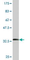 Anti-METTL2B Mouse Monoclonal Antibody [clone: 2A9]