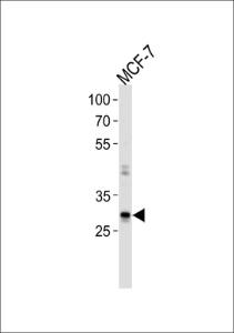 Anti-NANOG Rabbit Polyclonal Antibody (HRP (Horseradish Peroxidase))