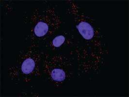 Anti-PDGFRB + FLT1 Antibody Pair