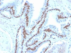 Immunohistochemical analysis of formalin-fixed, paraffin-embedded human skin using Anti-p40 Antibody [ZR8]