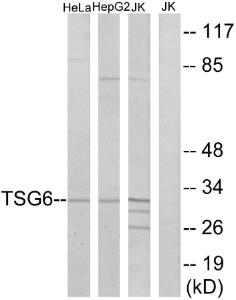 Western blot analysis of lysates from Jurkat, HeLa, and HepG2 cells using Anti-TSG6 Antibody. The right hand lane represents a negative control, where the antibody is blocked by the immunising peptide.