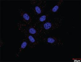 Anti-PDGFRB + FLT1 Antibody Pair