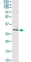 Anti-AGPAT2 Rabbit Polyclonal Antibody