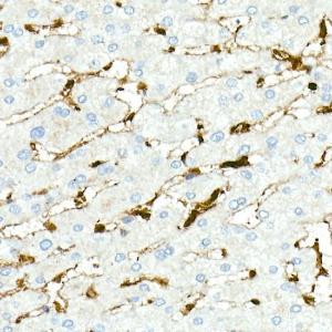 Immunohistochemistry analysis of paraffin-embedded human liver (positive control antibody staining, clone 55k-2) using Anti-Fascin Antibody [ARC1638] (A306042) at a dilution of 1:100 (40x lens)