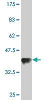 Anti-TARS Mouse Monoclonal Antibody [clone: 1A9]