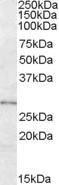 Anti-LYPLAL1 Antibody (A84485) (0.3 µg/ml) staining of Human Adipose lysate (35 µg protein in RIPA buffer). Primary incubation was 1 hour. Detected by chemilu minescence