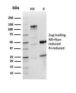 SDS-PAGE analysis of Anti-Lambda Light Chain Antibody [LLC/3774R] under non-reduced and reduced conditions; showing intact IgG and intact heavy and light chains, respectively. SDS-PAGE analysis confirms the integrity and purity of the antibody