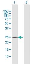 Anti-AGPAT2 Rabbit Polyclonal Antibody