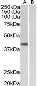 Antibody anti-TBP A82888-100 100 µg