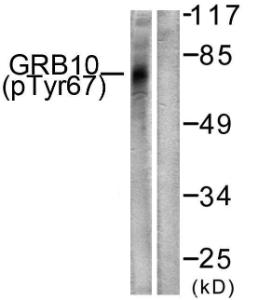 Antibody anti-GRB10 phospho TYR67 100 µg