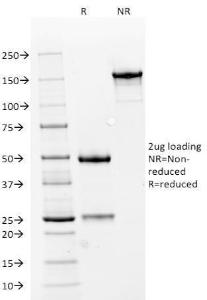 SDS-PAGE analysis of Anti-NCAM1 Antibody [NCAM1/784] under non-reduced and reduced conditions; showing intact IgG and intact heavy and light chains, respectively. SDS-PAGE analysis confirms the integrity and purity of the Antibody