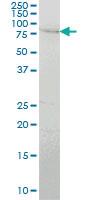 Anti-PEAK1 Mouse Monoclonal Antibody [clone: 1G9]