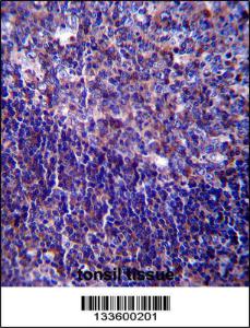 Anti-CD5 Rabbit Polyclonal Antibody (FITC (Fluorescein Isothiocyanate))