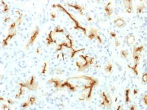 Immunohistochemical analysis of formalin-fixed, paraffin-embedded human pancreas using Anti-CFTR Antibody [CFTR/1775R]