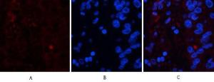 Immunofluorescence analysis of human liver-cancer tissue using Anti-FAS Antibody (red) at 1:200 (4°C overnight). Cy3 labelled secondary antibody was used at 1:300 (RT 50min). Panel A: Target. Panel B: DAPI. Panel C: Merge.