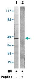 Anti-CK18 Rabbit Polyclonal Antibody