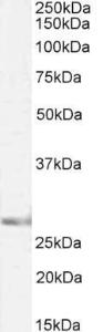 Anti-SIAH1 Antibody (A82889 / Biotin) (2µg/ml) staining of Mouse Brain lysate (35µg protein in RIPA buffer), exactly mirroring its parental non-biotinylated product. Primary incubation was 1 hour.