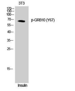 Antibody anti-GRB10 phospho TYR67 100 µg