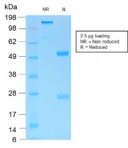 Antibody anti-MUC6 MUC61553R 100 µg