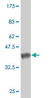 Anti-NXNL1 Mouse Monoclonal Antibody [clone: 7H3]