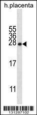 Anti-CRYBA1 Rabbit Polyclonal Antibody (Biotin)