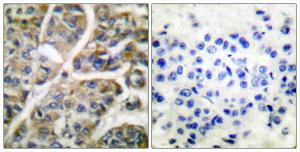 Antibody anti-granzyme B 100 µg