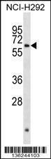 Anti-ARX Rabbit Polyclonal Antibody (APC (Allophycocyanin))