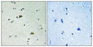 Antibody anti-GRB10 phospho TYR67 100 µg