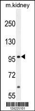 Anti-MED25 Rabbit Polyclonal Antibody (AP (Alkaline Phosphatase))