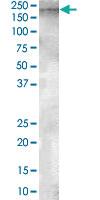 Anti-ENPEP Goat Polyclonal Antibody