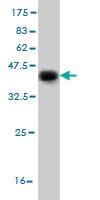 Anti-DFNB31 Mouse Monoclonal Antibody [clone: 1D9]