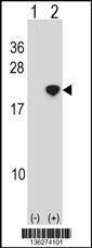 Anti-NANOS2 Rabbit Polyclonal Antibody (AP (Alkaline Phosphatase))