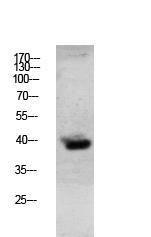 Antibody anti-granzyme B 100 µg