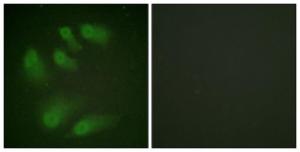 Antibody anti-CHK1 phospho SER286 100 µg