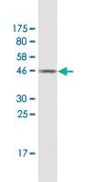 Anti-FTL Mouse Monoclonal Antibody [clone: 1C14]