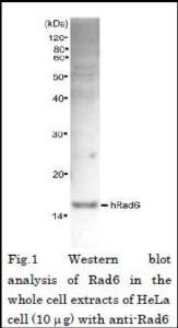 Anti-Rad6 Rabbit Polyclonal Antibody