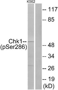 Antibody anti-CHK1 phospho SER286 100 µg