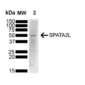 Anti-SPATA2L Mouse Monoclonal Antibody [clone: Z2 P2D5-C8]