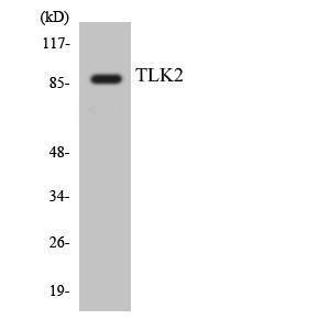 Western blot analysis of the lysates from HeLa cells using Anti-TLK2 Antibody