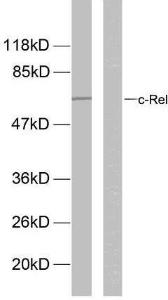 Western blot analysis of lysates from MDA-MB-435 cells using Anti-Rel (phospho Ser503) Antibody The right hand lane represents a negative control, where the antibody is blocked by the immunising peptide