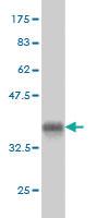 Anti-SGK1 Mouse Monoclonal Antibody [clone: 3C4]