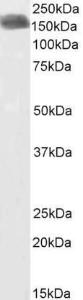 Anti-CLIP1 Antibody (A82891/Biotin) (1 µg/ml) staining of Human Breast Cancer lysate (35 µg protein in RIPA buffer). Primary incubation was 1 hour. Detected by chemilu minescence, using streptavidin-HRP and using NAP blocker as a substitute for skimmed milk